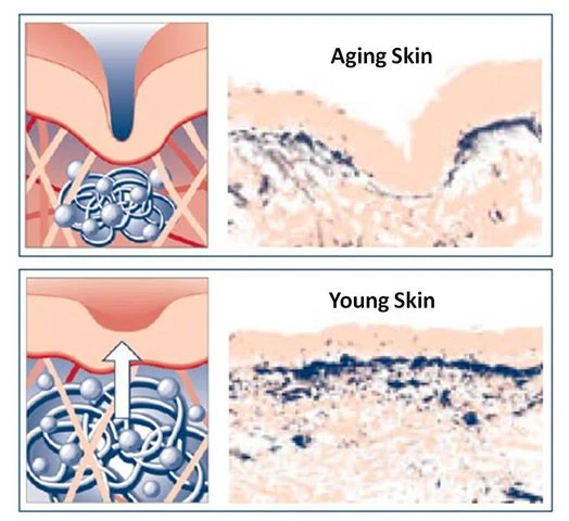 Hyaluronic-acid-aging-skin
